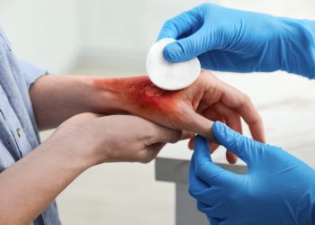 Hombre quema a su hermano tras discusión en Arroyo Hondo Abajo, Santiago