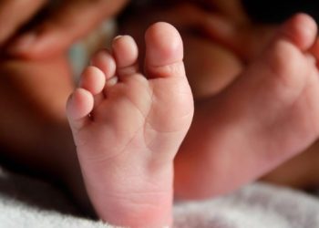 18 de marzo: Día Mundial del Síndrome de Edwards o Trisomía 18