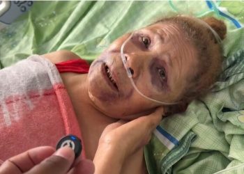 Anciana de 86 años es golpeada por haitianos y le prenden fuego a su vivienda en Cuaba Arriba, SFM