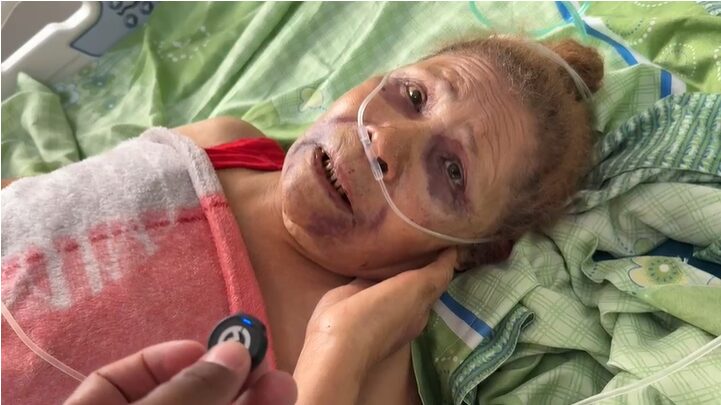 Anciana de 86 años es golpeada por haitianos y le prenden fuego a su vivienda en Cuaba Arriba, SFM
