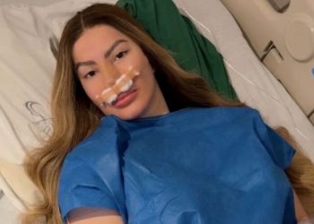 Alexandra MVP se somete a nueva cirugía en la nariz y pide a sus fans le deseen pronta recuperación