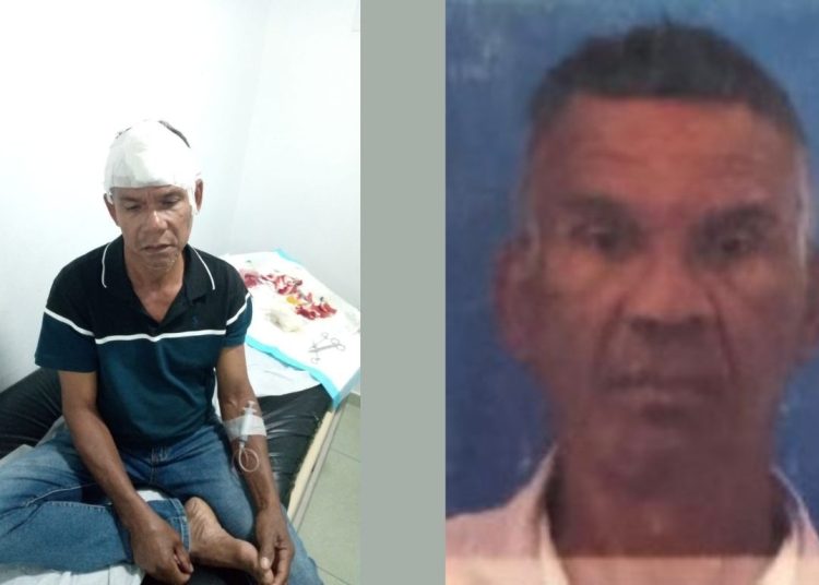 Conflicto por herencia termina en tragedia: coronel retirado mata a su hermano en SFM