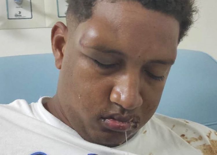Autoridades buscan familiares de hombre ingresado en hospital Teófilo Hernández en El Seibo