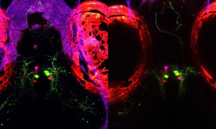 Una investigación sobre el sueño en peces podría abrir vías para tratar el insomnio en humanos