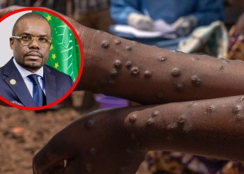 La República Democrática del Congo declara el fin de la viruela del mono