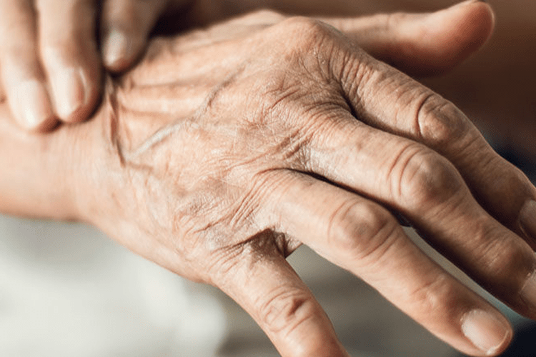 11 de abril: Día Mundial del Parkinson