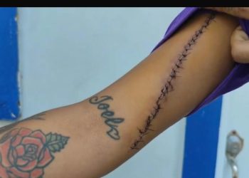 Por supuesta “mala palabra”, joven es herida con arma blanca y recibe unas 80 puntadas en Santiago