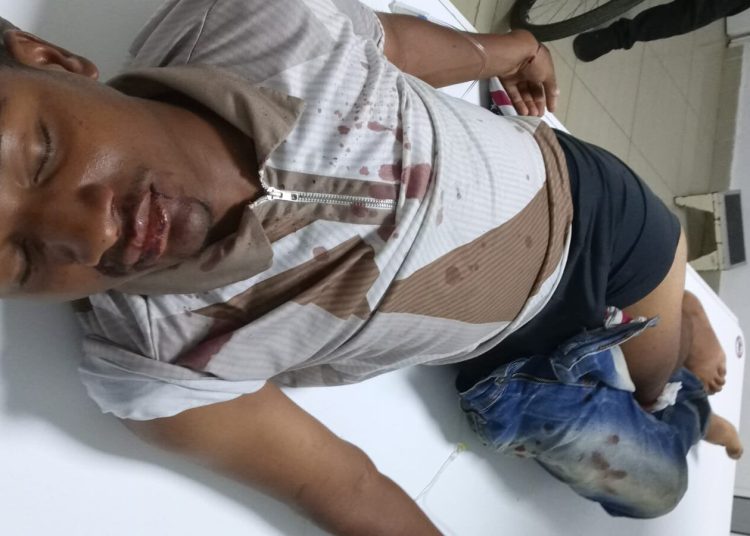Buscan a conductor que atropelló y abandonó a menor de edad en Sabana Grande de Boyá