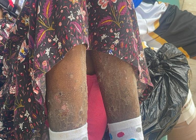 Denuncian abandono médico: niña enferma con extraña enfermedad espera por horas sin atención en hospital infantil de Santiago