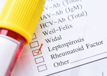 Salud Pública reporta aumento de leptospirosis en el país; casos ascienden a 74