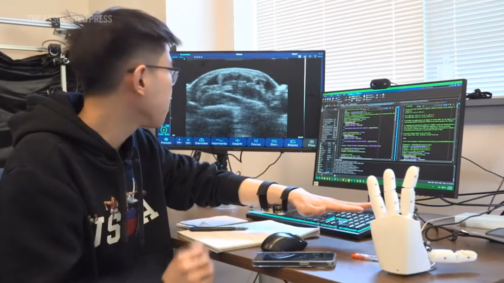 Pulsera del MIT permite a robots aprender habilidades humanas