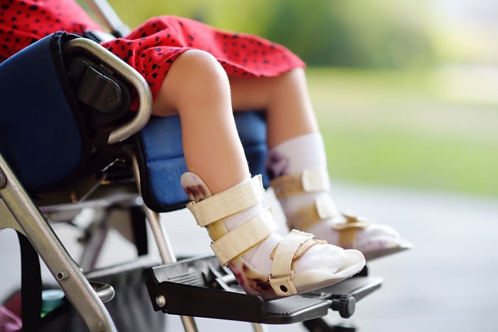 Pacientes con Atrofia Muscular Espinal exigen acceso urgente a tratamientos
