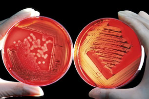 27 de junio: Día Mundial del Microbioma