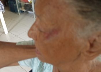 Adulta mayor de 84 años denuncia agresión por parte de hijo de crianza