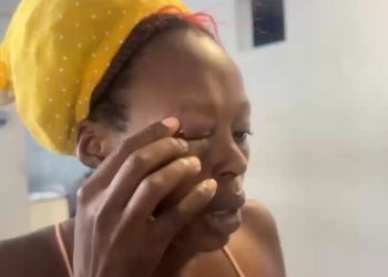 Hombre agrede a su expareja haitiana y le provoca lesiones en el rostro en San Francisco de Macorís