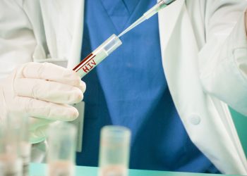 Uruguay registró 739 diagnósticos de infección por VIH en 2025, 93 menos que en 2024