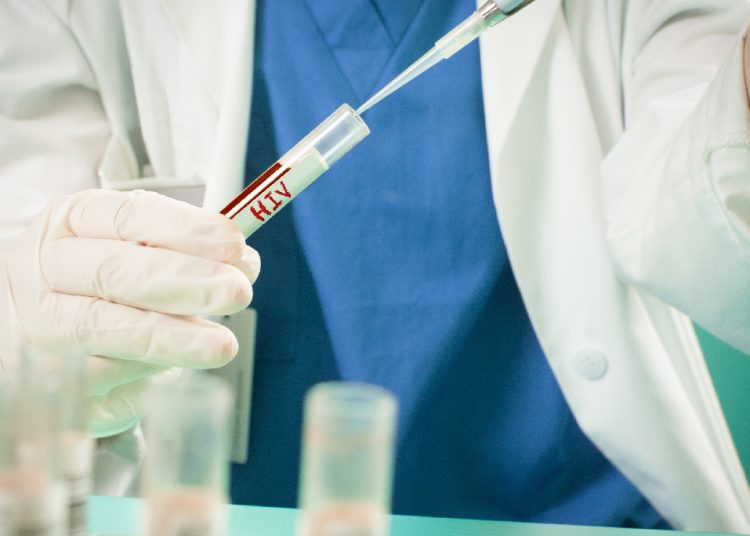 Uruguay registró 739 diagnósticos de infección por VIH en 2025, 93 menos que en 2024