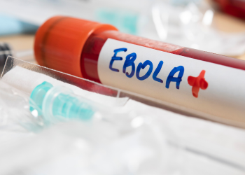 Epidemia de ébola cubre un territorio más grande que Francia y donde no hay liquidez