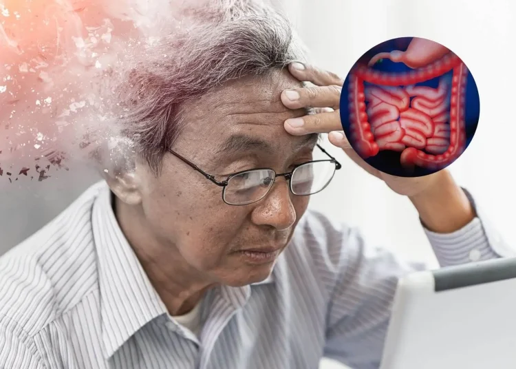 ¿Puede el intestino influir en el Alzheimer? Un estudio busca la respuesta