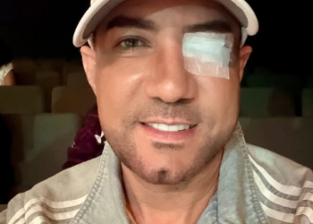 Marcos Yaroide revela que fue operado de emergencia por desprendimiento de retina