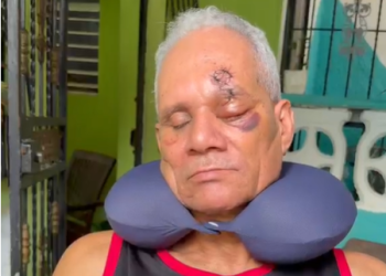 Hombre pierde ojo por agresión de jóvenes a botellazos; pide sean apresados
