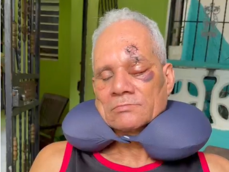 Hombre pierde ojo por agresión de jóvenes a botellazos; pide sean apresados