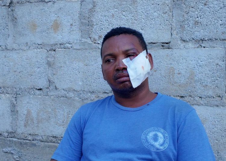 “Que se haga justicia”: padrastro de niño atropellado en Brisas del Este relata cómo ocurrió la tragedia