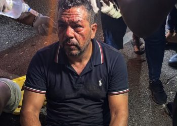 Accidente en Salcedo deja un hombre herido con fracturas en ambas piernas