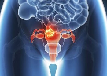 Cáncer ginecológico: las importantes señales que las mujeres no deben ignorar